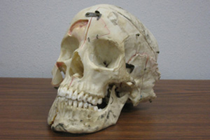 An actual human skull that has been cut into pieces and labeled for medical research. He even came with his own carrying case!